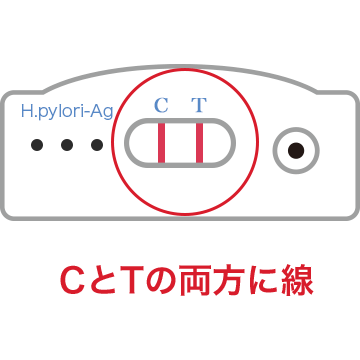 CとTの両方に線